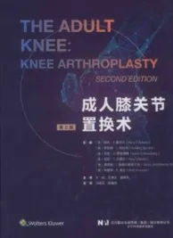 成人膝关节置换术 第2版