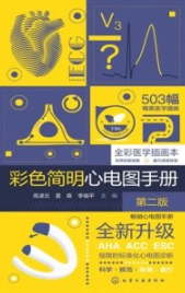 彩色简明心电图手册 第2版