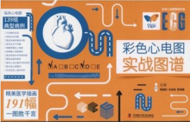 彩色心电图实战图谱