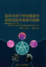超声引导下甲状腺结节穿刺活检术实践与创新