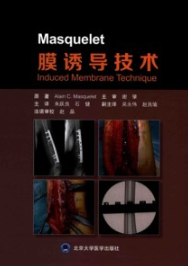 Masquelet膜诱导技术
