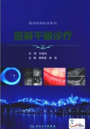 图解干眼诊疗