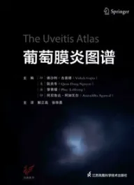 葡萄膜炎图谱