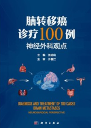 脑转移癌诊疗100例 神经外科观点
