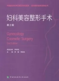 妇科美容整形手术 第2版