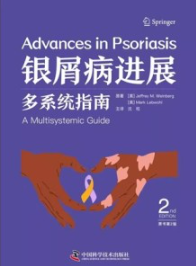 银屑病进展 多系统指南 原书第2版