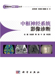 中枢神经系统影像诊断 影像诊断快速入门丛书