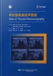 甲状腺疾病超声图谱
