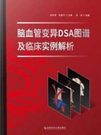 脑血管变异DSA图谱及临床实例解析