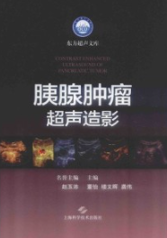 胰腺肿瘤超声造影