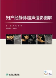 妇产经静脉超声造影图解