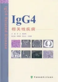 IgG4相关性疾病
