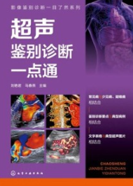 超声鉴别诊断一点通