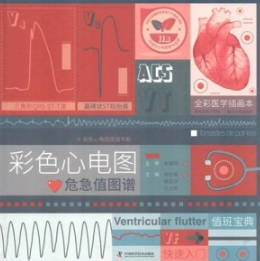 彩色心电图危急值图谱