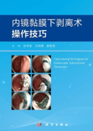 内镜黏膜下剥离术操作技巧