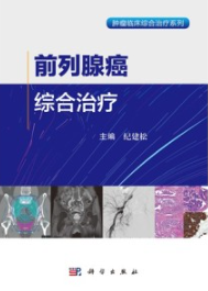 前列腺癌综合治疗