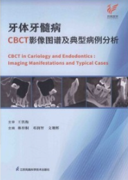 牙体牙髓病CBCT影像图谱及典型病例分析