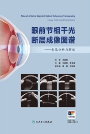 眼前节相干光断层成像图谱 影像分析与解读