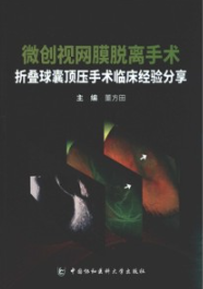 微创视网膜脱离手术