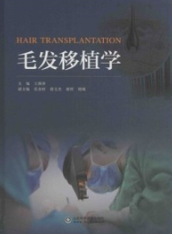 毛发移植学