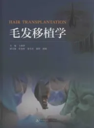 毛发移植学