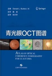 青光眼OCT图谱