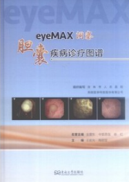 eyeMAX洞察 胆囊疾病诊疗图谱