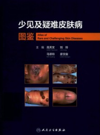 少见及疑难皮肤病图鉴
