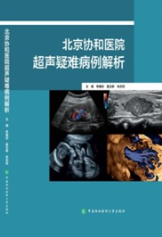 北京协和医院超声疑难病例解析