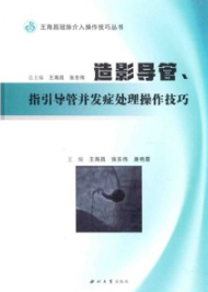 造影导管、指引导管并发症处理操作技巧