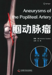 腘动脉瘤
