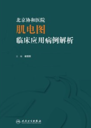 北京协和医院肌电图临床应用病例解析