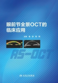 眼前节全景OCT的临床应用