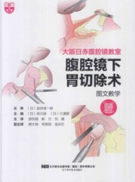 腹腔镜下胃切除术图文教学