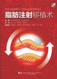 脂肪注射移植术