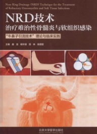 NRD技术治疗难治性骨髓炎与软组织感染 “牛鼻子引流技术”理论与临床实践