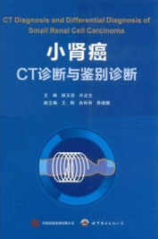 小肾癌CT诊断与鉴别诊断