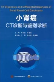 小肾癌CT诊断与鉴别诊断