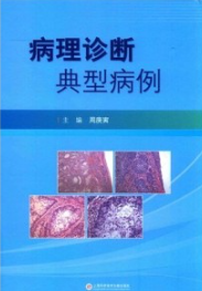 病理诊断典型病例