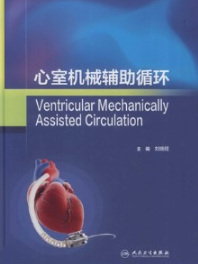 心室机械辅助循环