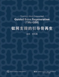 钛网支撑的引导骨再生