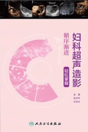 循序渐进 妇科超声造影轻松掌握