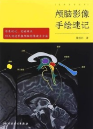颅脑影像手绘速记