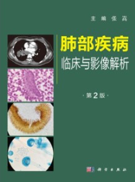 肺部疾病临床与影像解析（第2版）