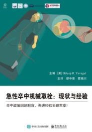 急性卒中机械取栓 现状与经验