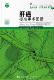 肝癌标准手术图谱