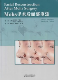 Mohs手术后面部重建