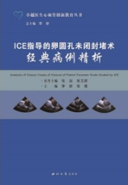 ICE指导的卵圆孔未闭封堵术经典病例精析