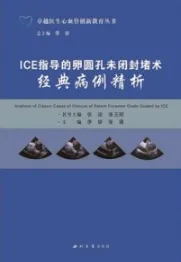 ICE指导的卵圆孔未闭封堵术经典病例精析