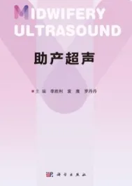 助产超声